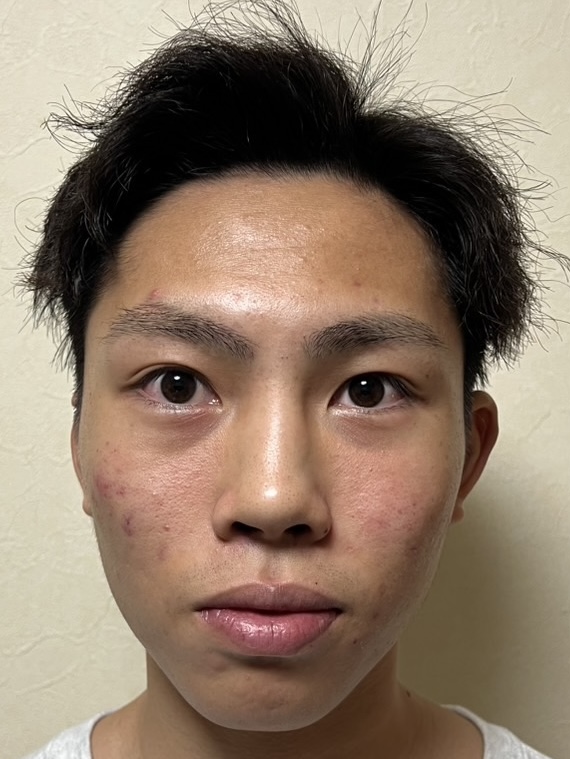 辻 永久（ツジトキ）選手情報
